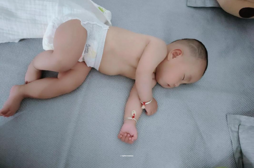 澳门六个月宝宝眼睛散光